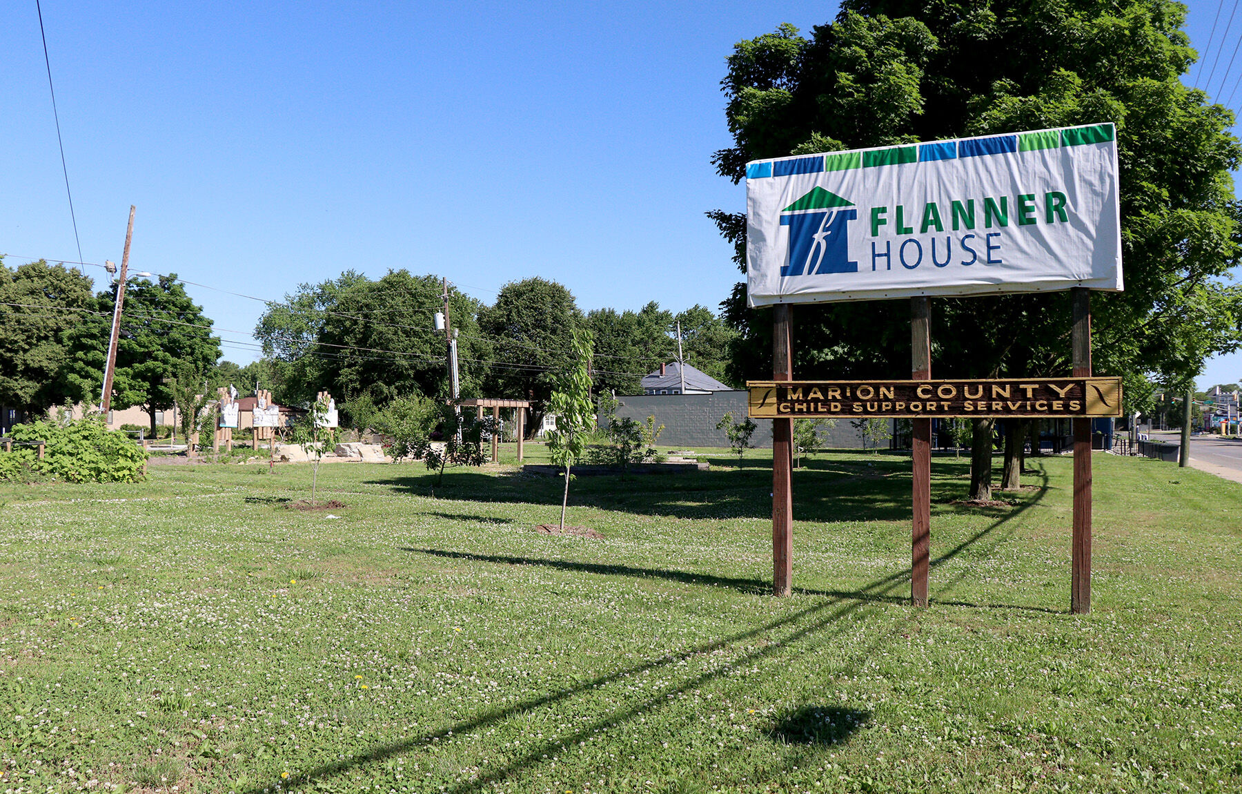 Flanner sign